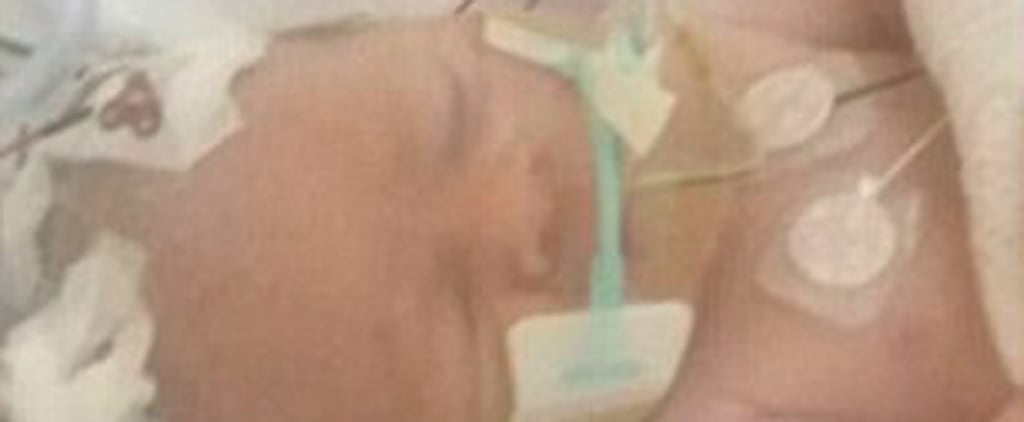 Unborn Baby Survives Car Accident That Kills Mom