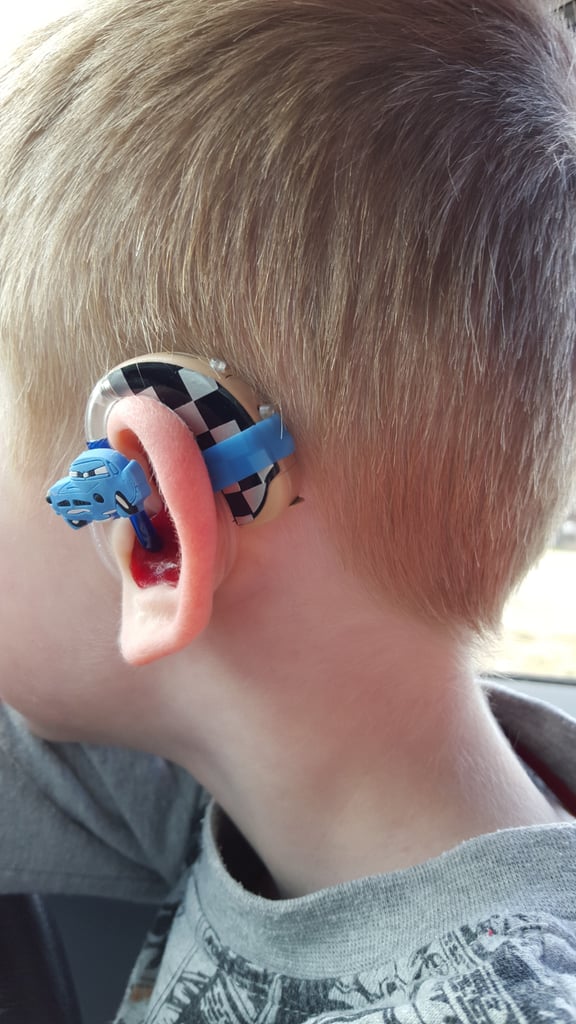 Mom Creates Superhero Hearing Aids For Son