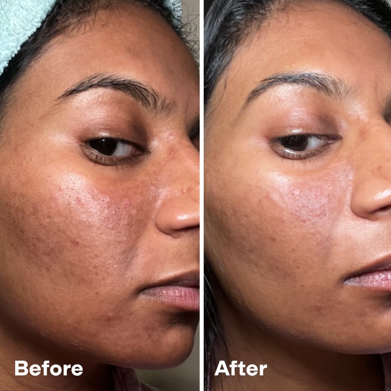 Before and after using the Dr. Dennis Gross Skincare DermInfusions Blur + Repair Cream on bare skin.