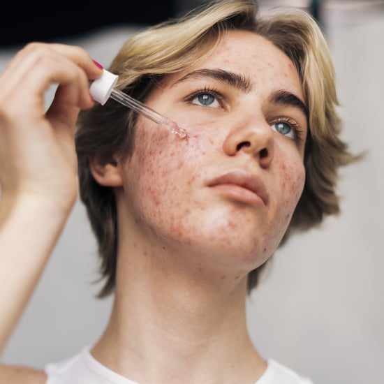 How to Treat Pimples Under the Skin, According to Derm