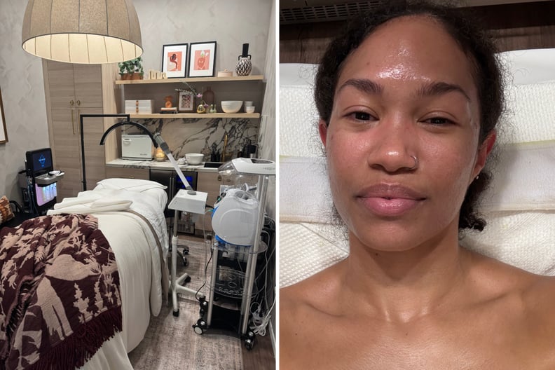 hydrafacial before and after 