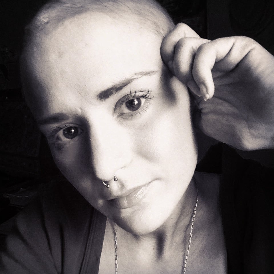 Alopecia Sufferer's GoFundMe Page