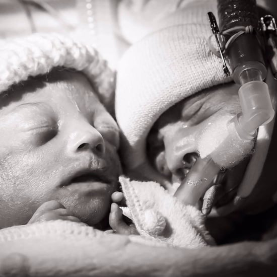 Photo of Twin Who Died From TTTS