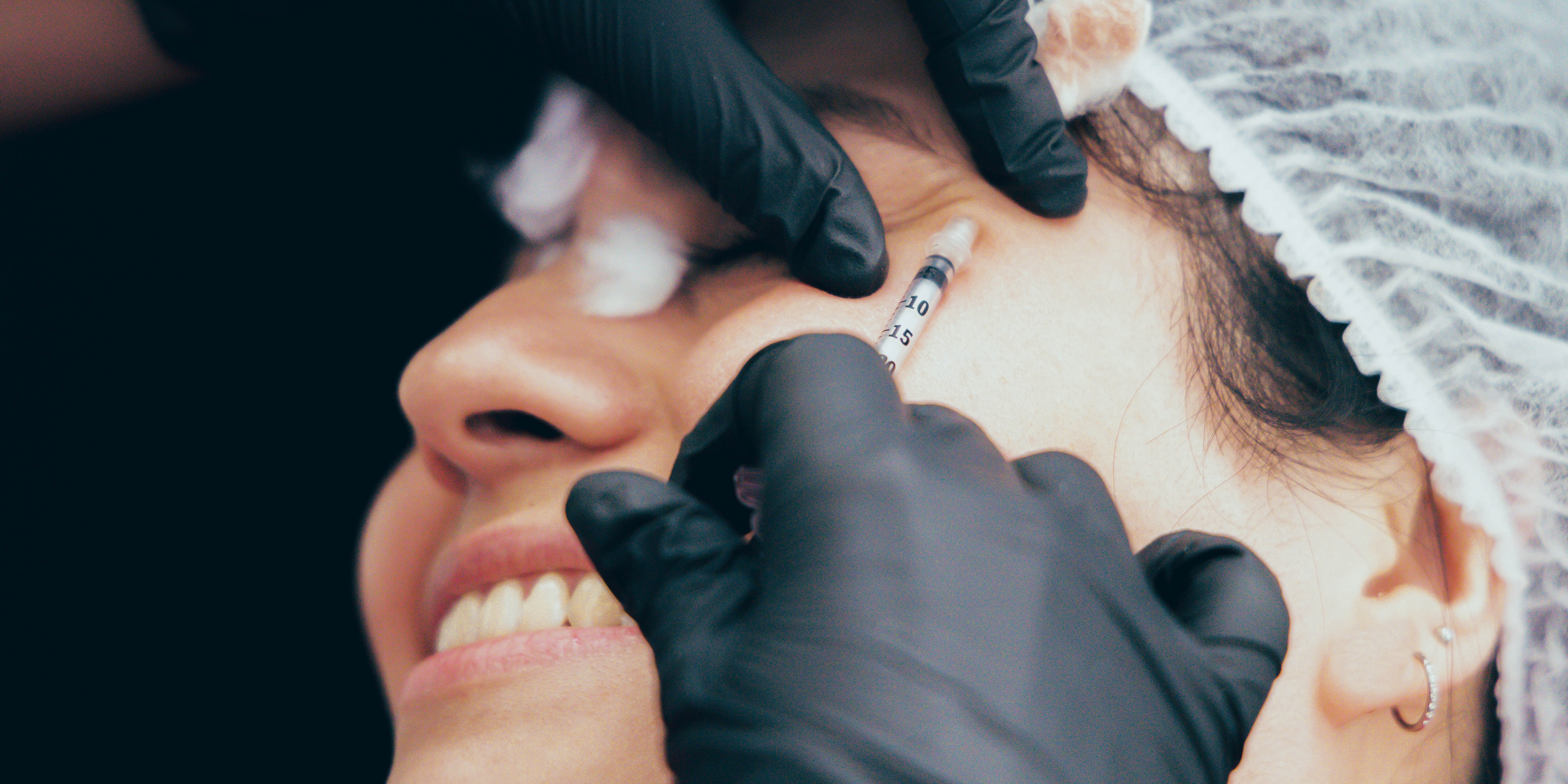 The 411 on "Jelly Roll" Botox — A Treatment For Puffy Undereyes