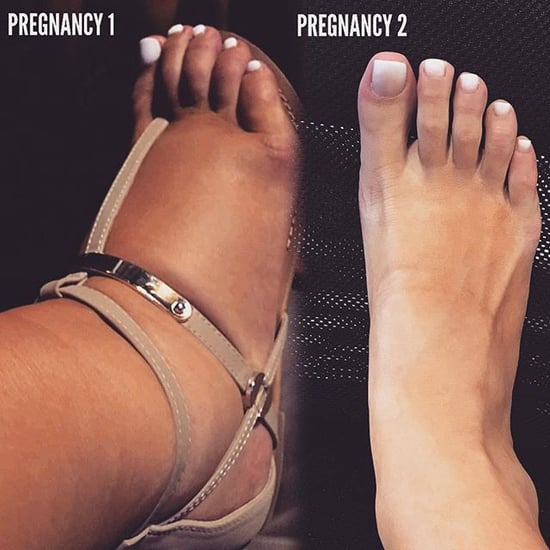 Foot Photo That Proves No 2 Pregnancies Are the Same