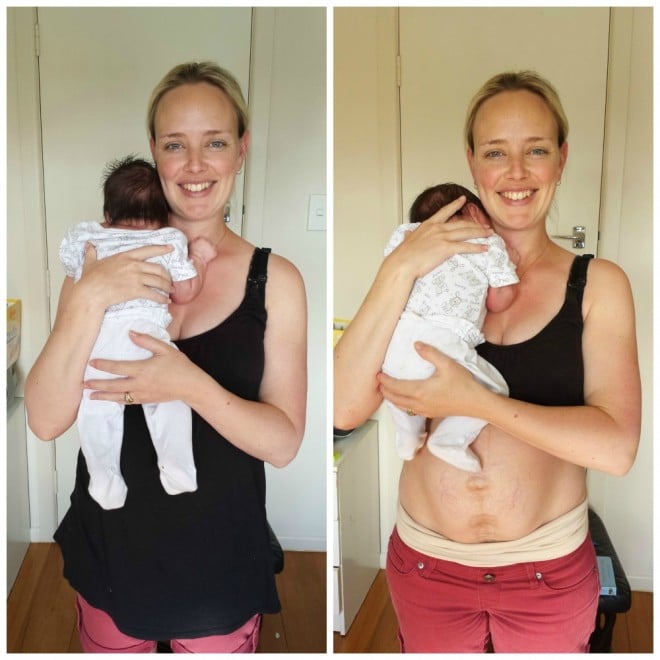 Postpartum Body Expectations