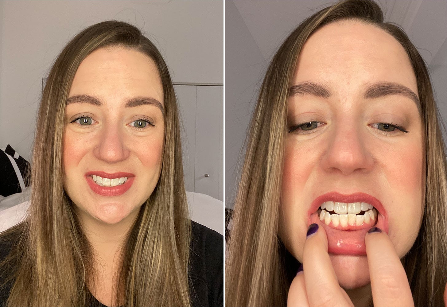 Smile Direct Club Teeth Aligners Review and Photos | POPSUGAR Beauty UK