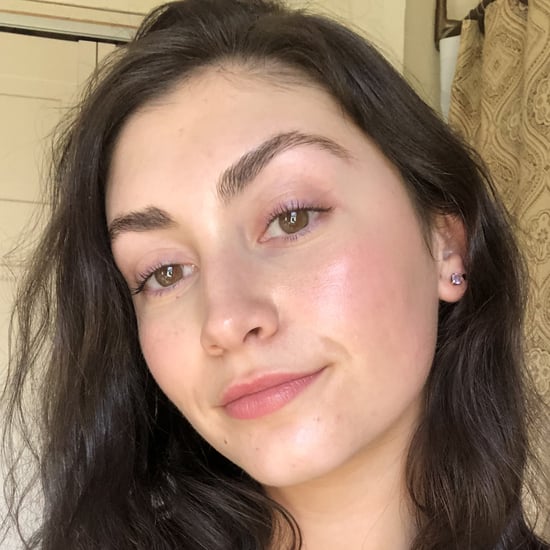 Adult Hormonal Acne Personal Essay