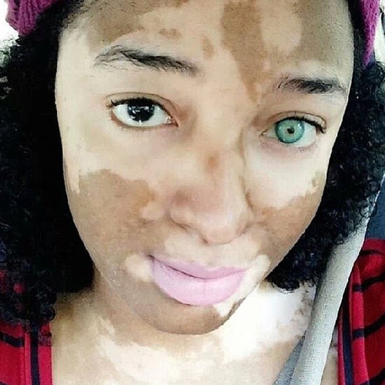 In My Skin I Win Campaign