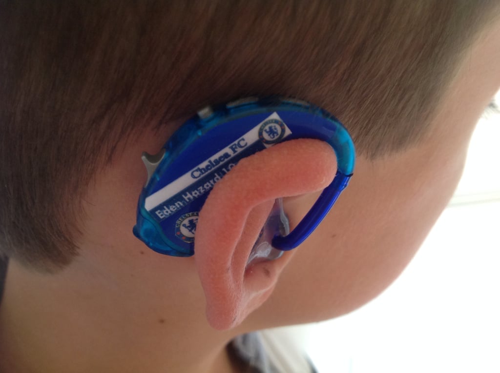 Mom Creates Superhero Hearing Aids For Son
