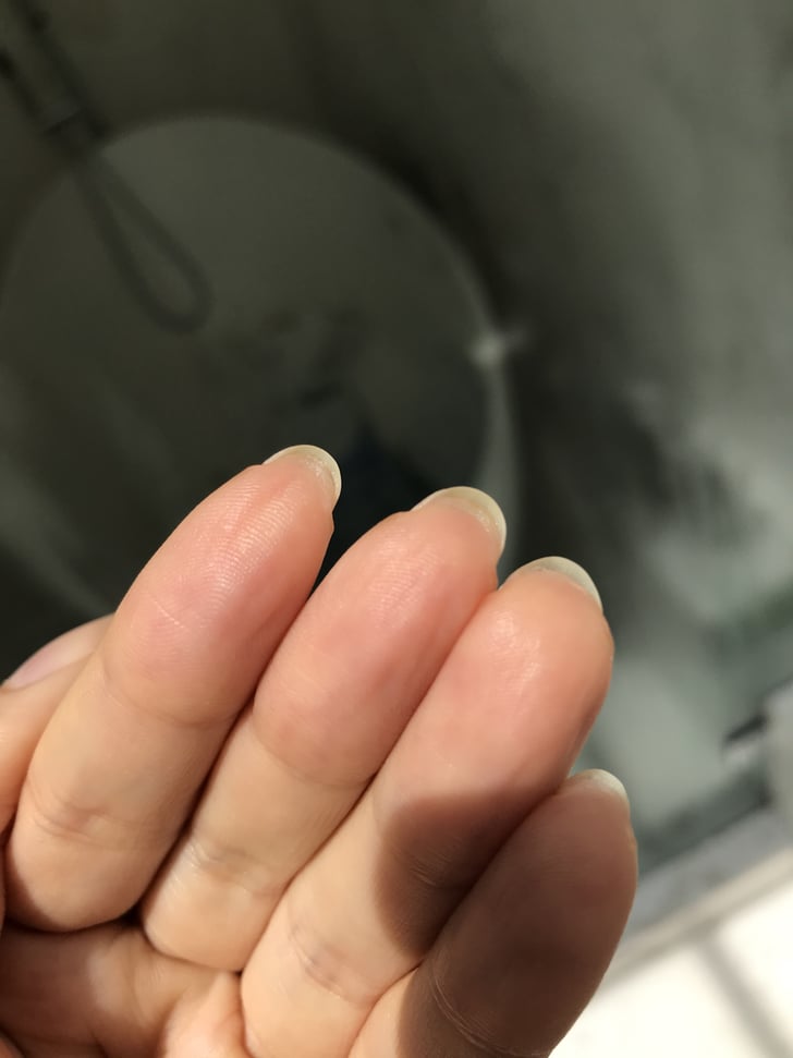 I was able to peel back the dead skin hiding under my nail : r/peeling