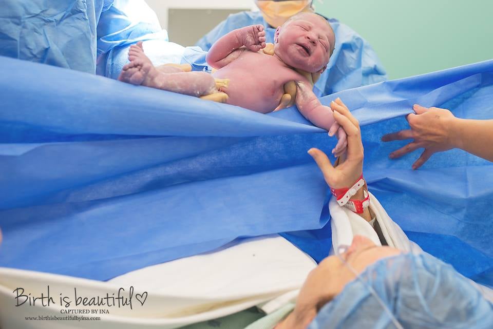 C-Section Birth Photography - POPSUGAR Family Photo 26