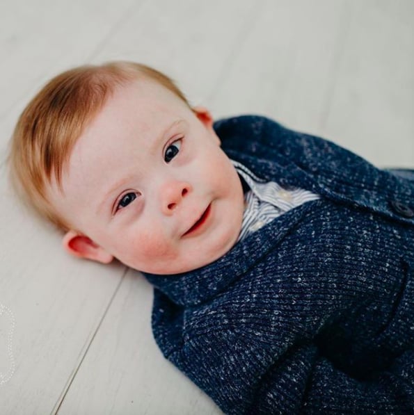 Photos of Babies With Down Syndrome