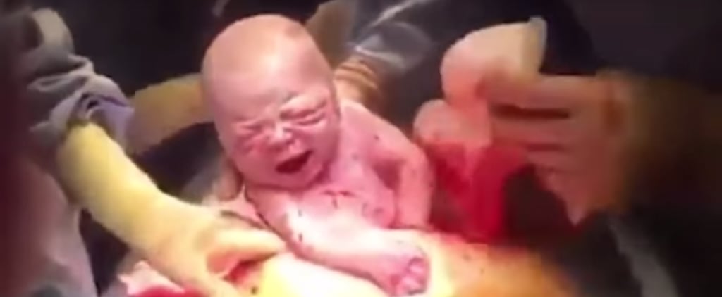 Mom Films Her Own C-Section Birth