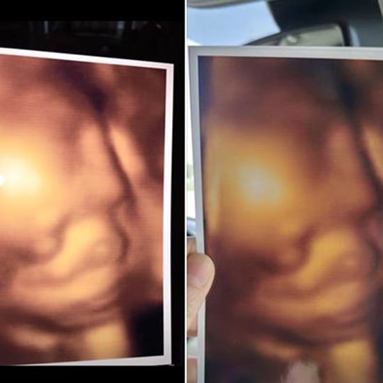 3D Ultrasound Clinic Scam Gives Parents Identical Photos