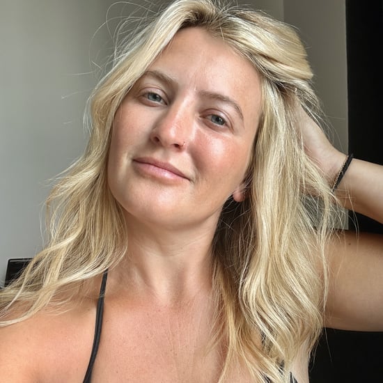 Scandi Hairline Before and After: See My Results
