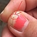 Kid Tick Bites