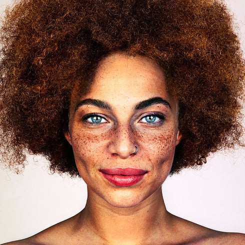Photos of People With Freckles