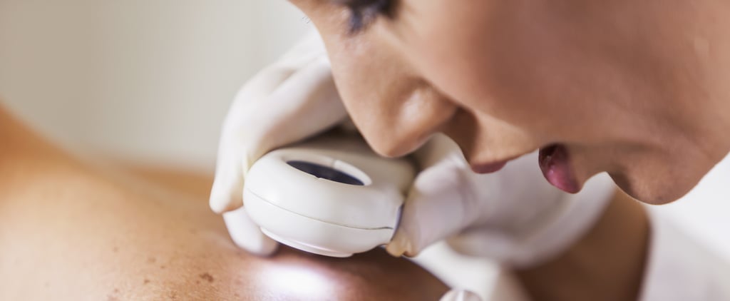 Melanoma: What It Looks Like, Risks, Symptoms, and More