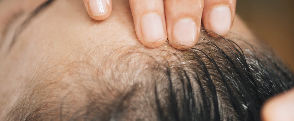 Rosemary Water For Hair Growth: Does It Work?