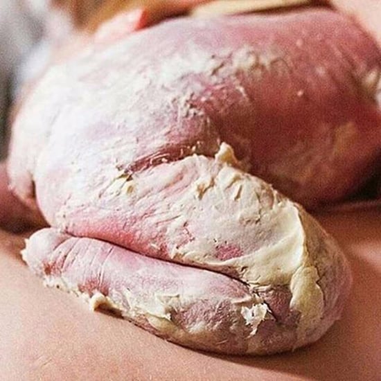 What Is Vernix?