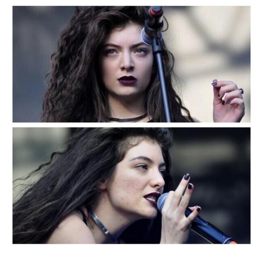 Lorde Slams Photoshopping and Shows Image of Her Acne