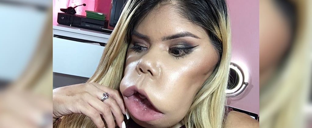 Beauty Blogger With Tumor | Video