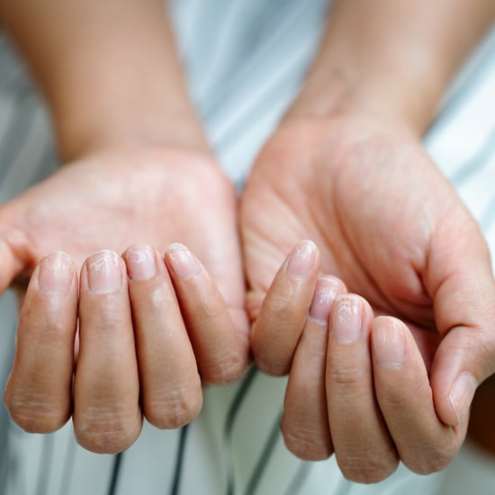 剥落的指甲:原因和治疗方法