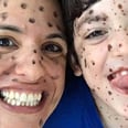 Mom's Surprising Message to the Strangers Who Made Fun of Her Son's "Dots"
