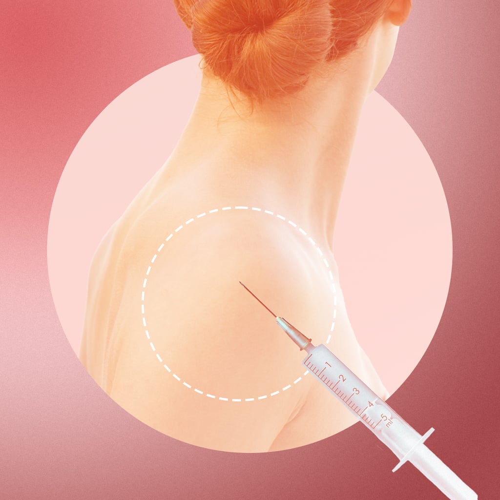 Trapezius Botox: What to Know, Benefits, Before and Afters | POPSUGAR ...