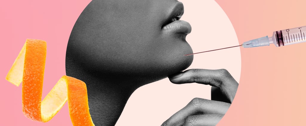 Why I Got Botox For My Dimpled Chin