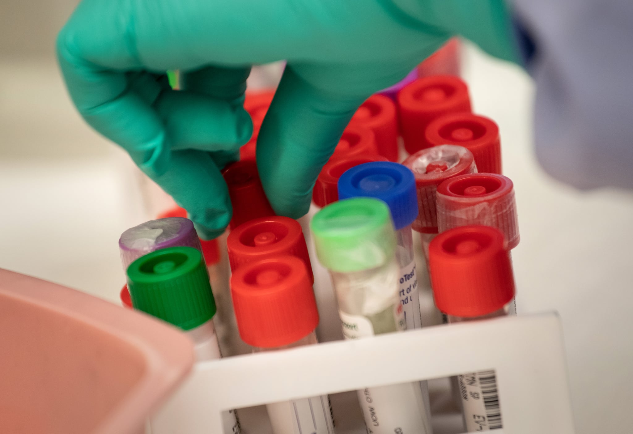 SEATTLE, WASHINGTON - MARCH 13: A medical Laboratory scientist tests vials of samples for coronavirus at the University of Washington Medicine virology lab on March 13, 2020 in Seattle, Washington. The lab is processing about 1,500 tests for COVID-19 daily and hopes to increase to 5000 in the following weeks. (Photo by John Moore/Getty Images)