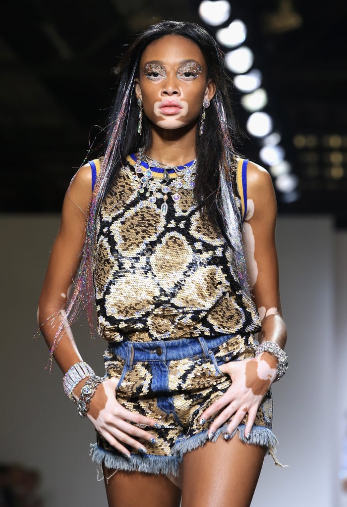 Winnie Harlow