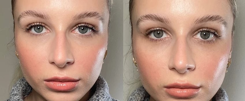 Upneeq Eye Drops Review With Photos