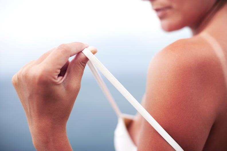 Stop going out in the sun without sunblock.