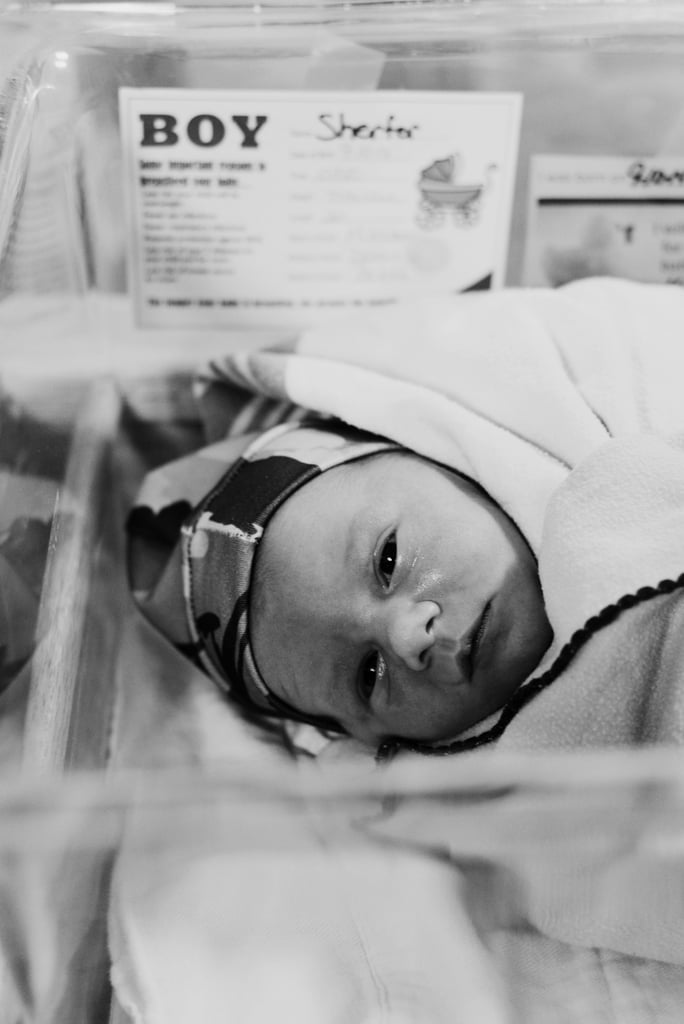 Dramatic C-Section Birth Photos