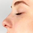 The Innovative Ultrasonic Rhinoplasty Cuts Down on Recovery Time