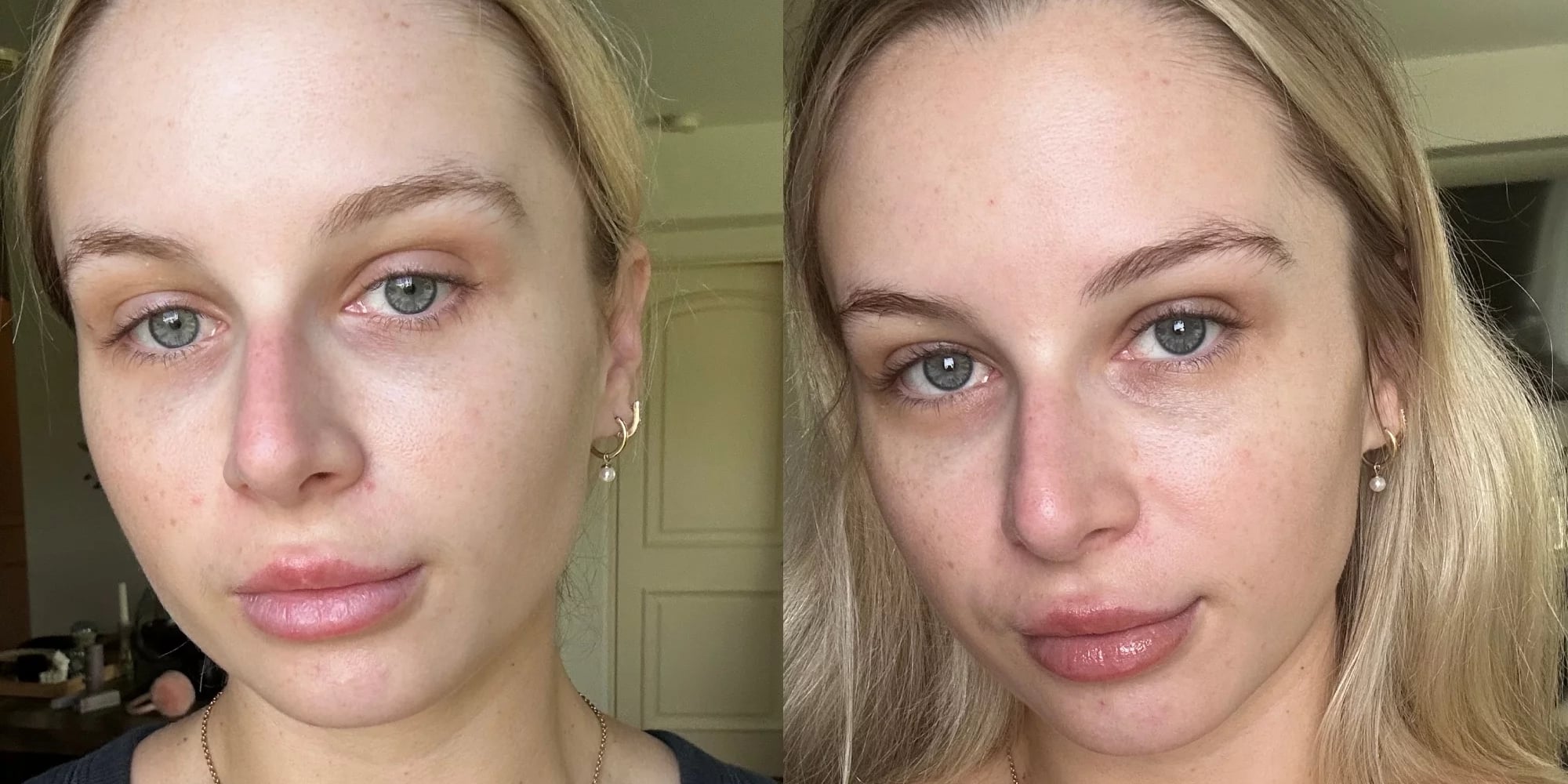 Dr. Brandt Revitalizing Face Serum Review With Photos - Vimarsana News