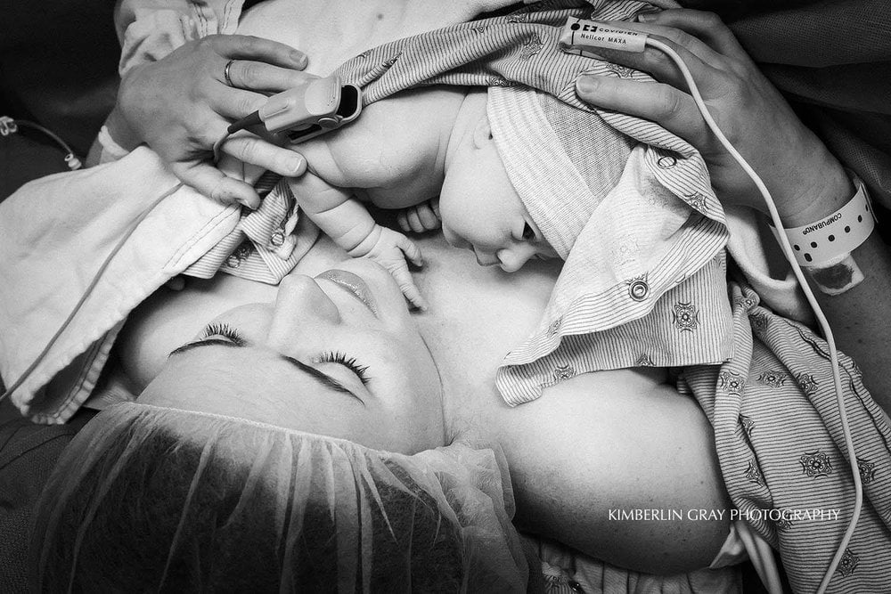 C-Section Birth Photography