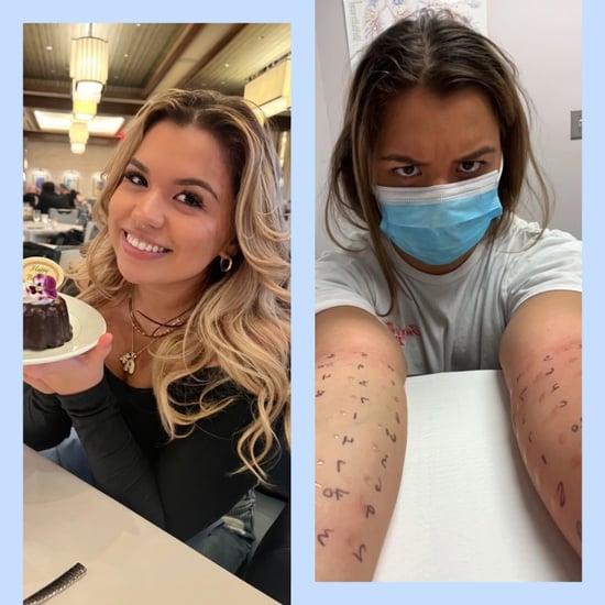 What It's Like Living With Chronic Allergies