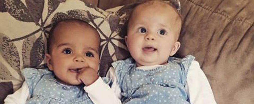 Twin Born With Different Skin Tones