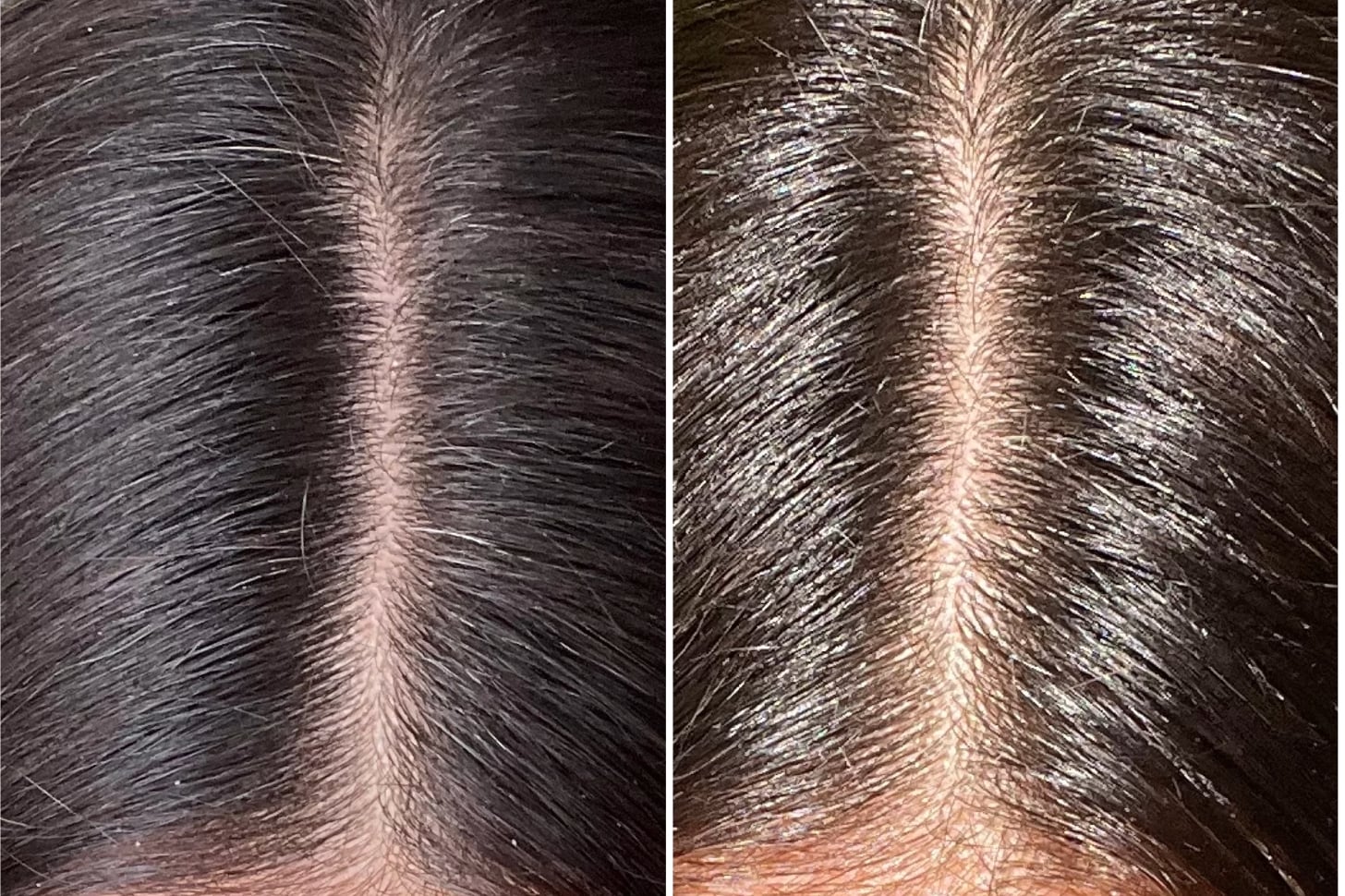 Scalp Detox Editor Experiment