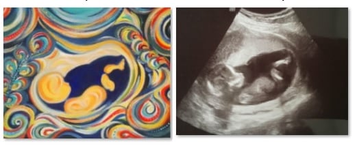 Ultrasound art