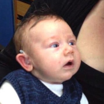 7-week Old Hears For the First Time