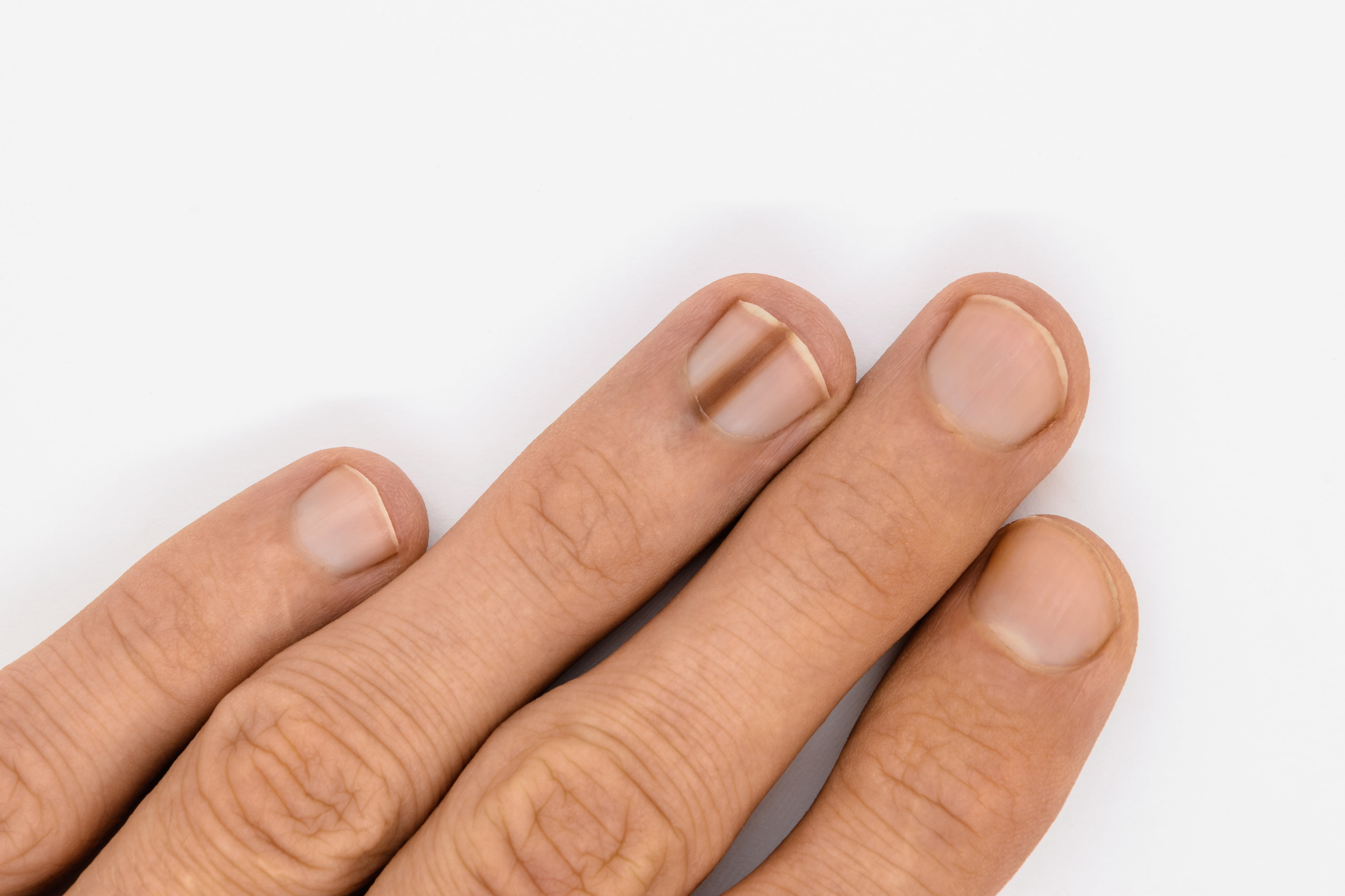 Pin on Fingernail health