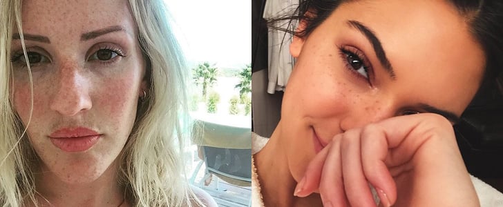 Real Girls With Freckles