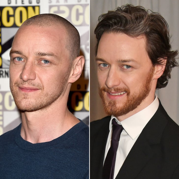 James McAvoy  Male Celebrities With Hair vs. Shaved Heads 