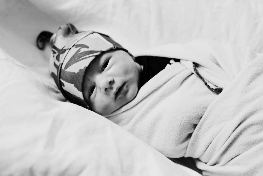 Dramatic C-Section Birth Photos
