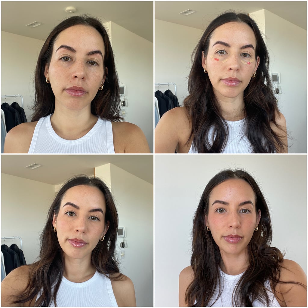 Under Eye Filler Before And After Photos The Ultimate Beauty Hack - bstm2ch