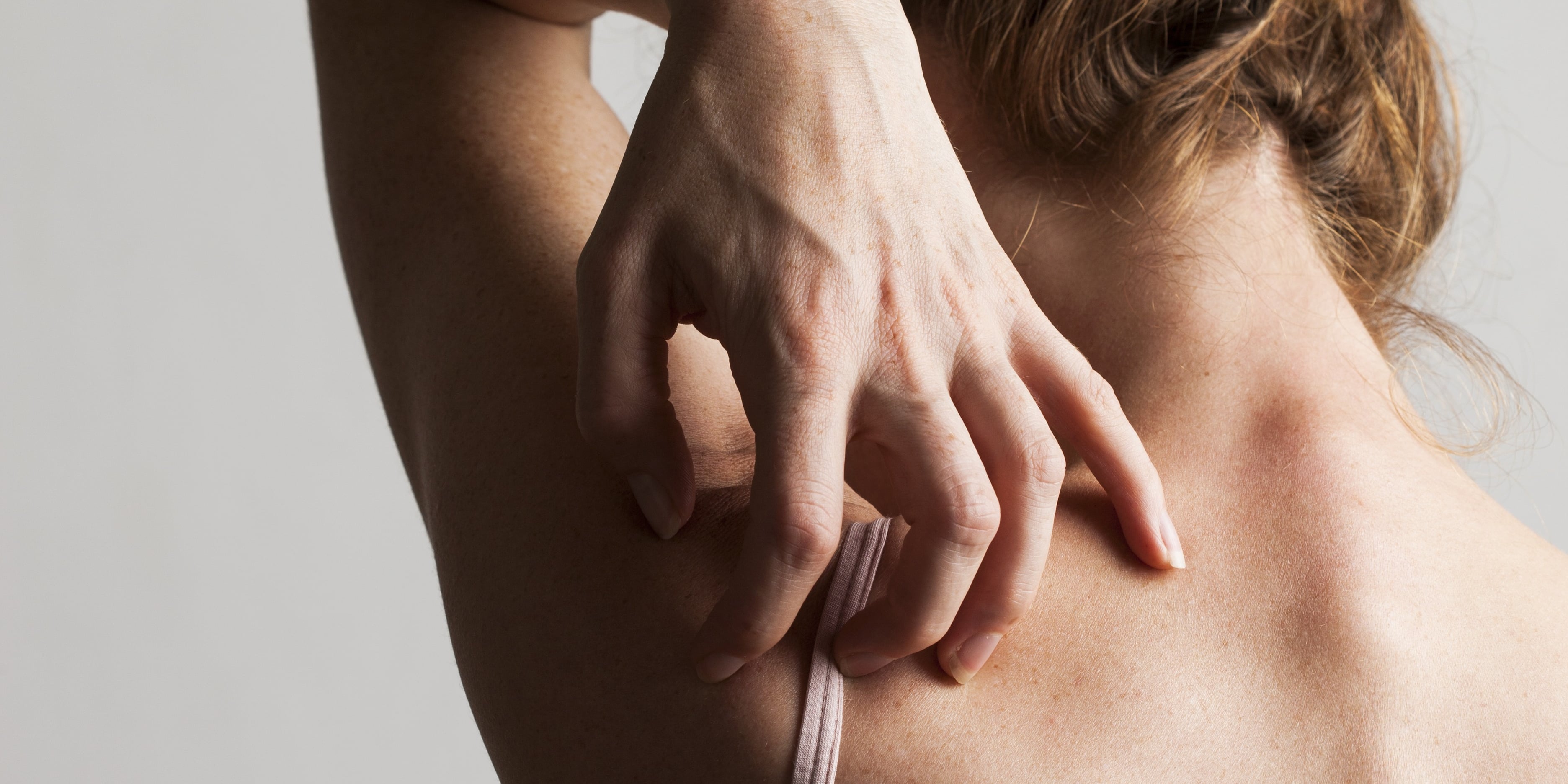 Doctors Explain the Difference Between Eczema vs. Psoriasis